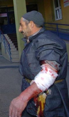 Aciller doldu, taştı!.. 1