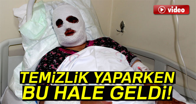 Temizlik yaparken dikkatsizlik kadını bu hale getirdi