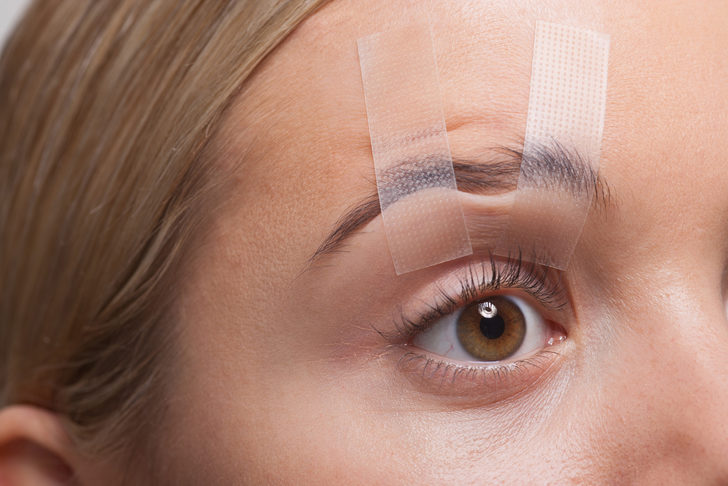 Göz estetiği ameliyatları nedir, nasıl yapılır ve neden gereklidir?