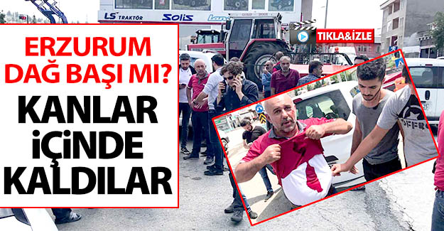 Erzurum'da Baba-oğul silahlı kişilerce darp edildi!