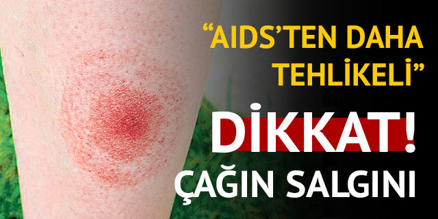 Lyme hastalığı nedir? Uzmanlar uyarıyor: Çağın salgını