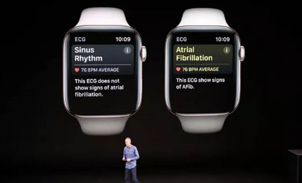 Apple Watch, o özellikler için yasalara takıldı!