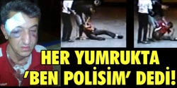 Her yumrukta 'Ben polisim' dedi!