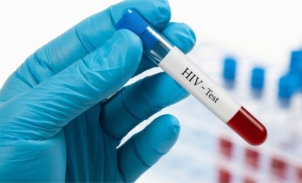 Türkiye’de HIV pozitif sayısı arttı
