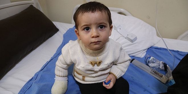 Kaynar Sütle Yanan 1,5 Yaşındaki Çocuk Tedavi Altına Alındı