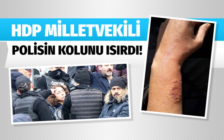 HDP'li milletvekili polis memurunun kolunu ısırdı