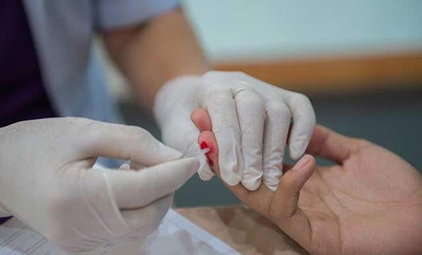 Dikkat! HIV virüsü kendini böyle ele veriyor