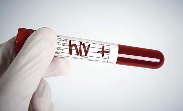 Yeni HIV türü keşfedildi