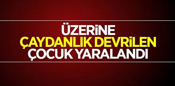 Çaydanlığı üzerine döken çocuk feci şekilde yandı