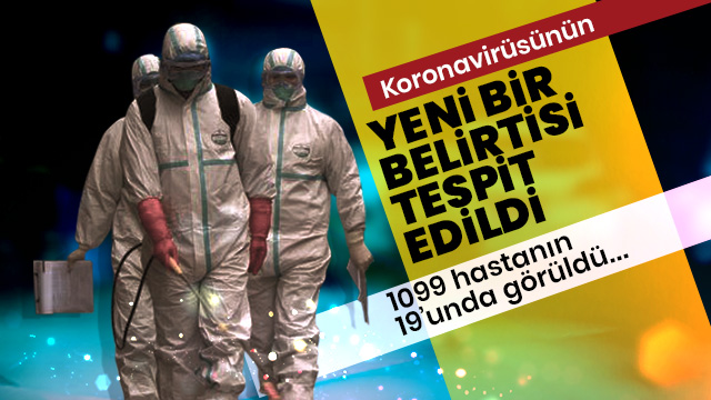 Koronavirüsün yeni belirtisi tespit edildi: Konjonktivit