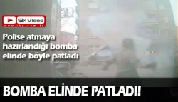 Bomba elinde patladı!