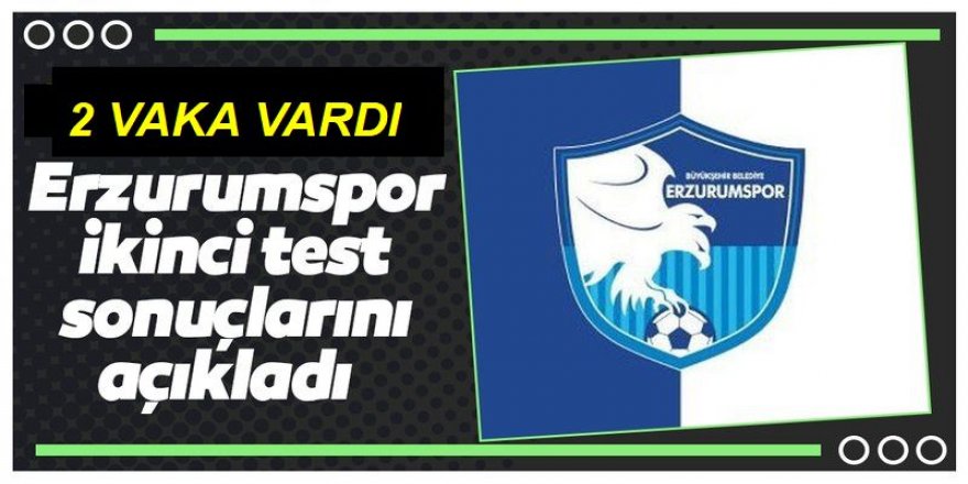 Erzurumspor'da Kovid-19'a rastlanmadı