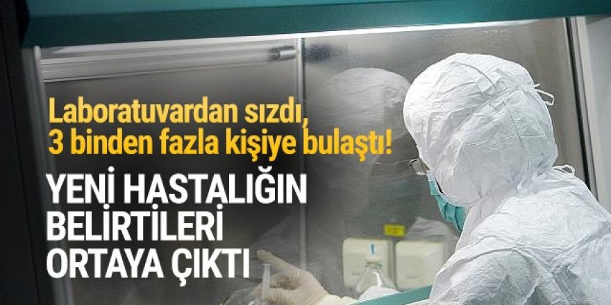 Yeni hastalığın belirtileri ortaya çıktı