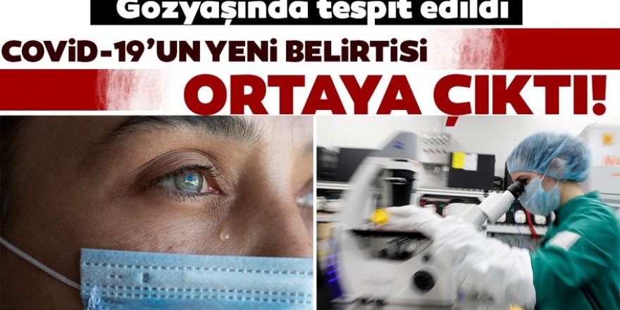 Coronavirüste yeni belirti! Gözyaşında ortaya çıktı