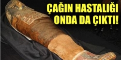 Mumyada Çağın Hastalığı