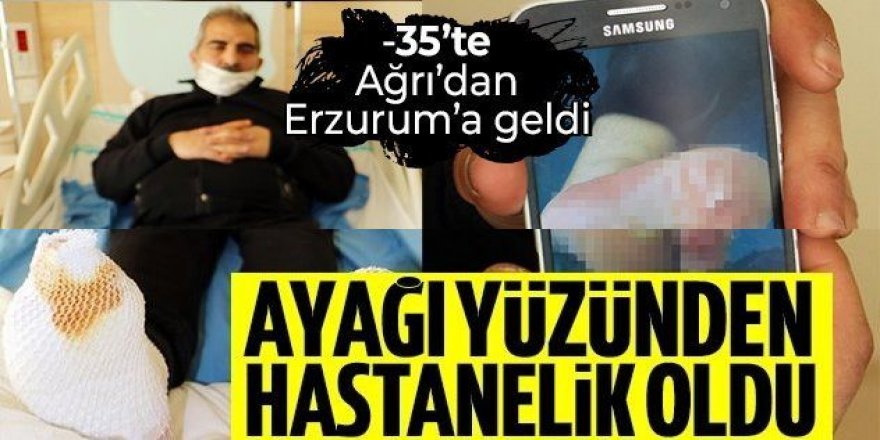 Ayaklarında soğuk yanığı oluşan kargo şoförü Erzurum'da tedaviye alındı