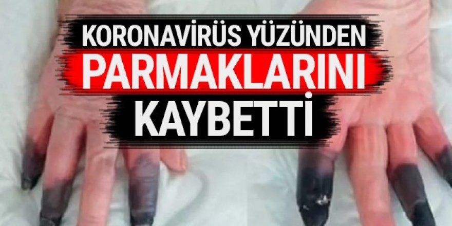 Koronavirüs hastası 3 parmağını kaybetti!