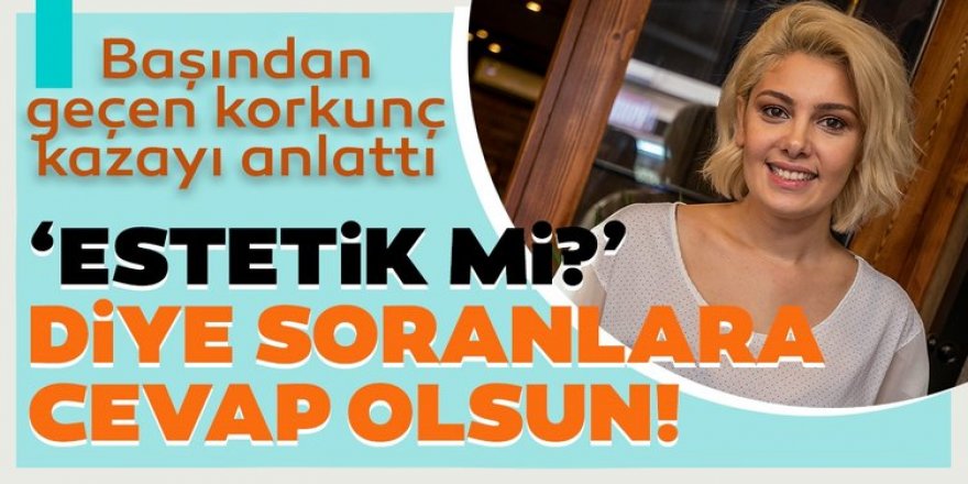 Burcu Binici: Uçakta burnum kırıldı hostes bayıldı