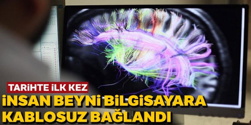 İnsan beyni kablo olmadan bilgisayara bağlandı