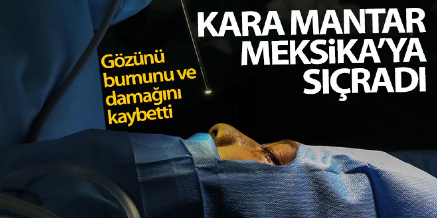 Kara mantar hastalığı Meksika'ya da sıçradı