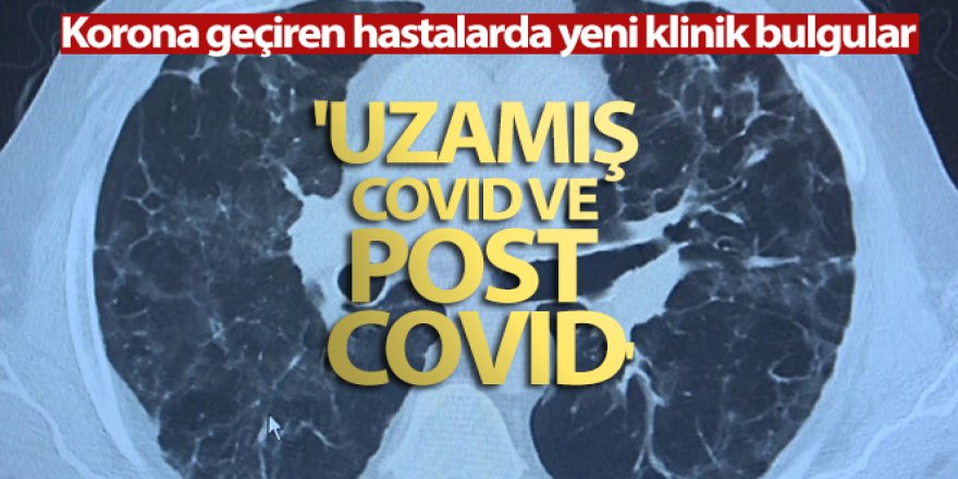 Korona virüs geçiren hastalarda yeni klinik bulgular: 'Uzamış Covid ve post Covid'