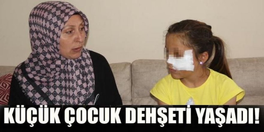 Amcaoğlu küçük kıza demir boruyla dehşeti yaşattı