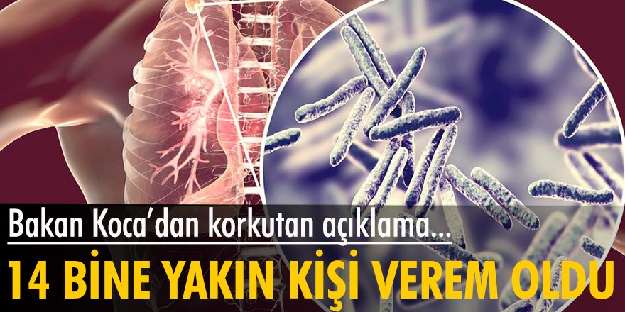 Bakan Koca açıkladı: 14 bine yakın kişi verem oldu