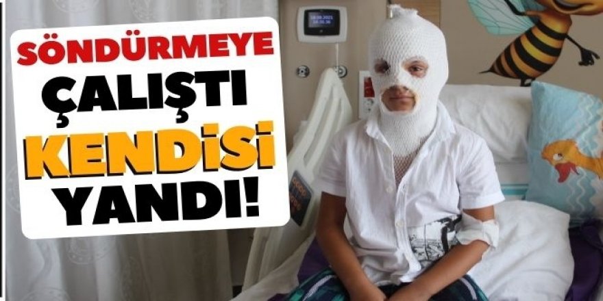 Yangını söndürmeye çalışırken kendisi yandı