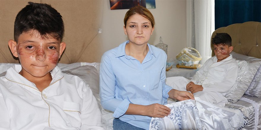 Erzurum'da Sünnet Çocuğunu Hastanelik Ettiler