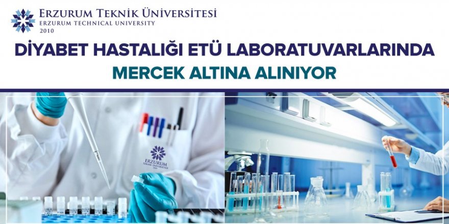 Diyabet , ETÜ laboratuvarlarında mercek altında