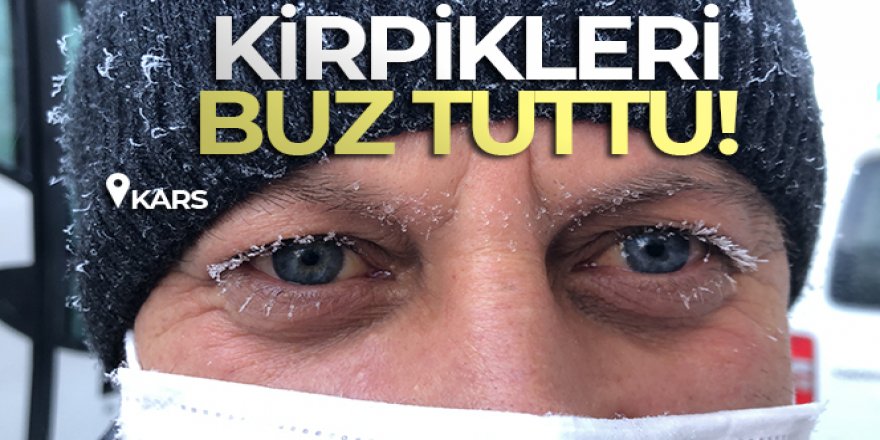 Kars'ta soğuktan vatandaşın kirpikleri buz tuttu