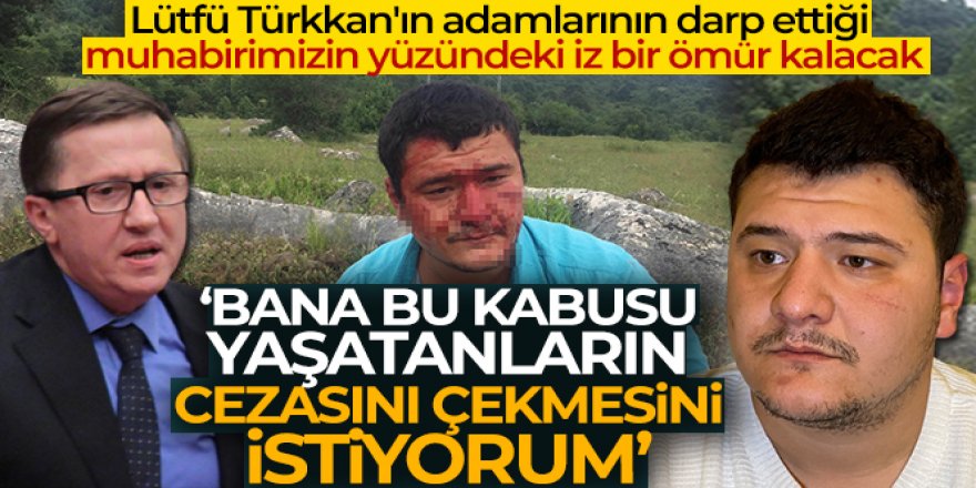 Lütfü Türkkan'ın adamlarının darp ettiği muhabirimizin yüzündeki iz bir ömür kalacak