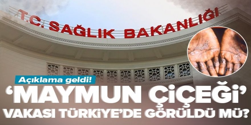 Türkiye'de maymun çiçeği vakası görüldü mü? Açıklama geldi.