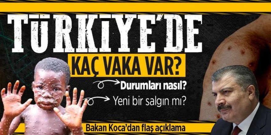 Bakan Koca: 'Şu ana kadar ülkemizde 5 maymun çiçeği virüsü hastası tespit edildi'