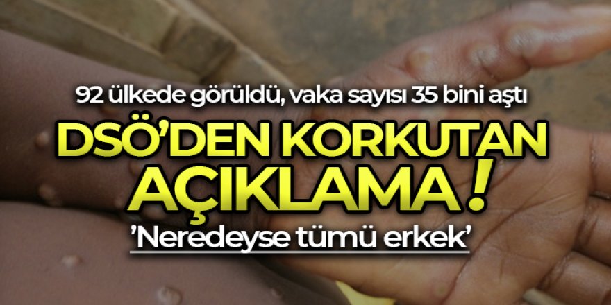 Maymun çiçeği virüsü 92 ülkede görüldü: Dünya genelindeki vaka sayısı 35 bini aştı