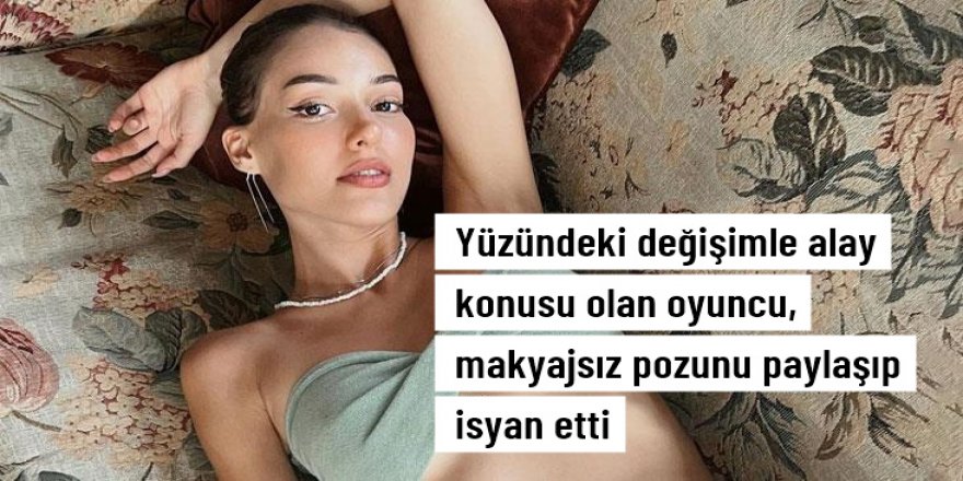 Dilan Çiçek Deniz, makyajsız pozunu yayınlayarak estetik iddiasını yalanladı