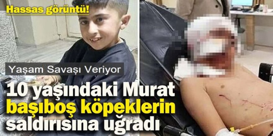 Köpeklerin saldırdığı küçük Murat’ın yaşam savaşı sürüyor