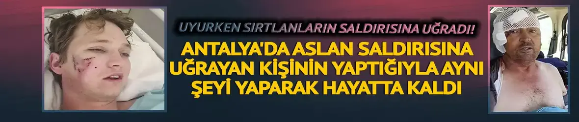 Uyurken sırtlanların saldırısına uğradı!