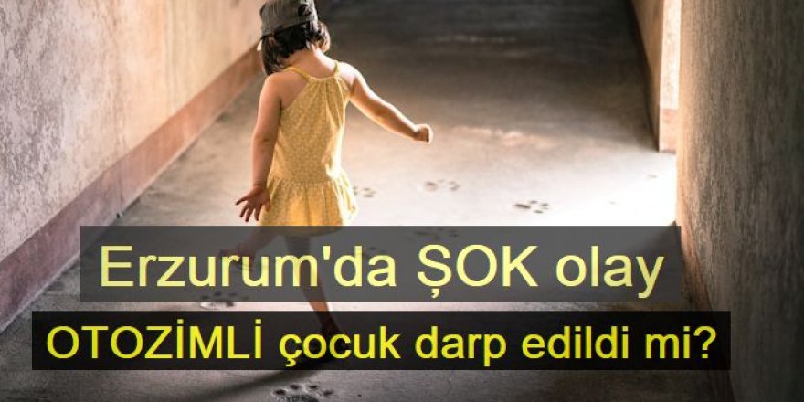 Erzurum'da Otozimli çocuğa darp iddiası
