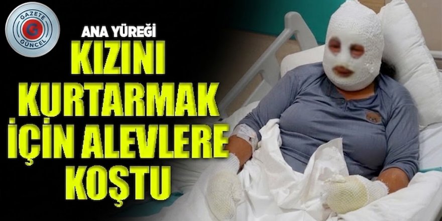 Kızını yangından kurtarırken ağır yaralanan annenin tedavisi sürüyor