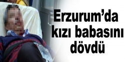 Öz kızı tarafından darp edildi