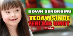 Down sendromu tedavisinde yeni bir umut