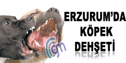 Erzurum'da köpek saldırısı: 2 yaralı