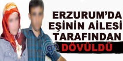 Eşinin ailesi tarafından dövüldü