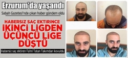 Habersiz saç ektirince takımdan kovuldu