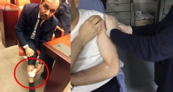 CHP Milletvekili, AK Partili Balta'yı ısırdı