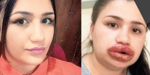 Merve hemşirenin başına gelenlere dikkat!