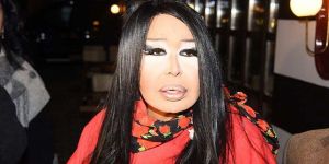Bülent Ersoy’un dişi kırıldı!