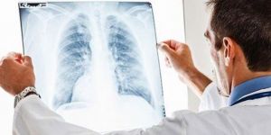 Zatürre nedir neden olur nasıl geçer? Bitkisel tedavi yöntemleri