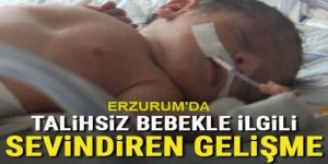 Talihsiz bebekle ilgili sevindiren gelişme
